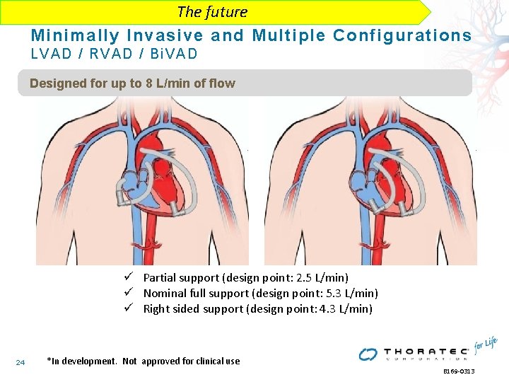 The future Minimally Invasive and Multiple Configurations LV AD / RVAD / Bi. VAD The future Minimally Invasive and Multiple Configurations LV AD / RVAD / Bi. VAD