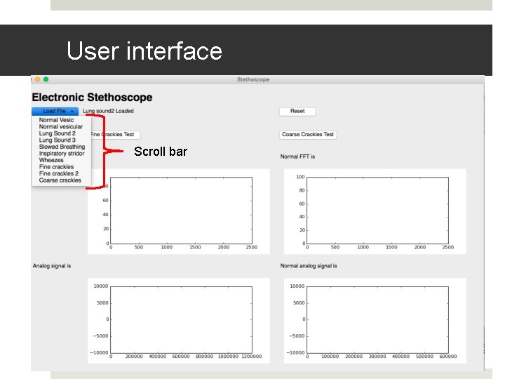 User interface Scroll bar 