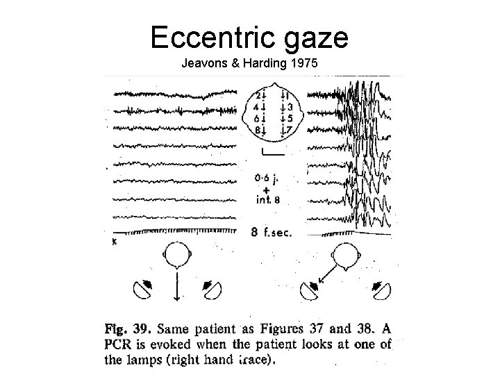 Eccentric gaze Jeavons & Harding 1975 