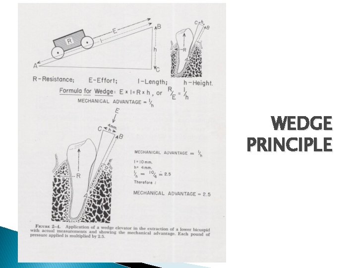 WEDGE PRINCIPLE 