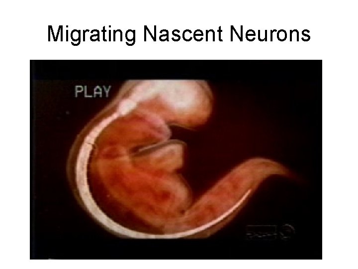 Migrating Nascent Neurons 