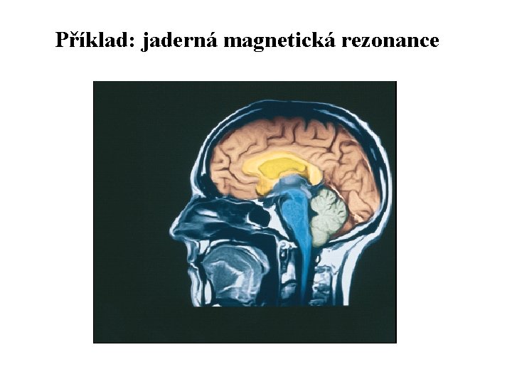 Příklad: jaderná magnetická rezonance 