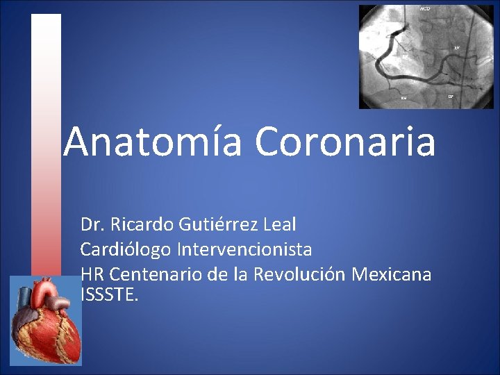 Anatomía Coronaria Dr. Ricardo Gutiérrez Leal Cardiólogo Intervencionista HR Centenario de la Revolución Mexicana