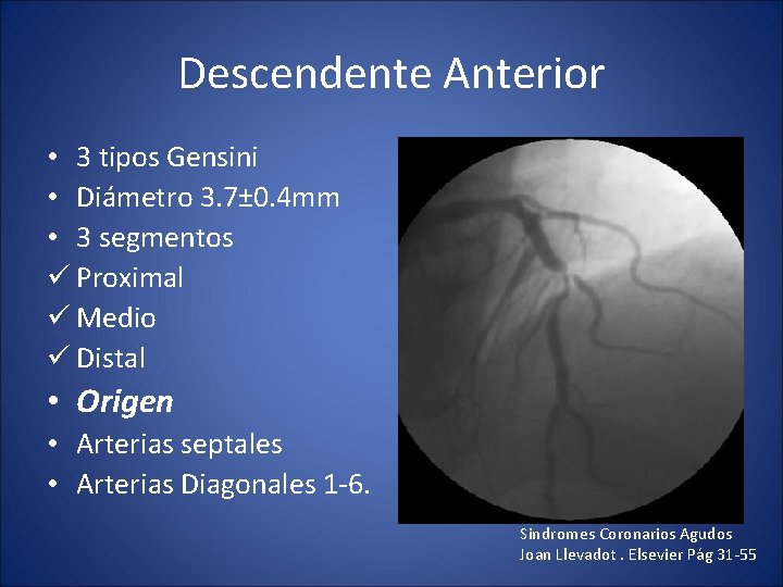 Descendente Anterior • 3 tipos Gensini • Diámetro 3. 7± 0. 4 mm •