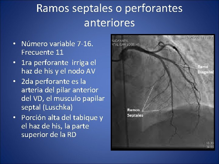 Ramos septales o perforantes anteriores • Número variable 7 -16. Frecuente 11 • 1
