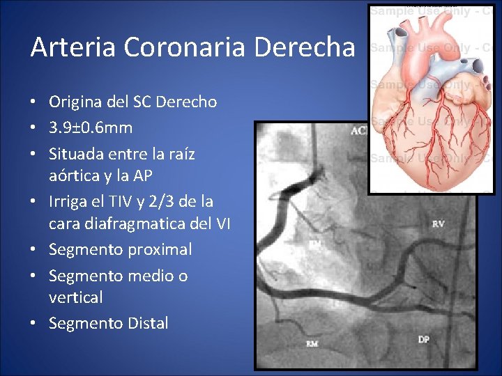 Arteria Coronaria Derecha • Origina del SC Derecho • 3. 9± 0. 6 mm