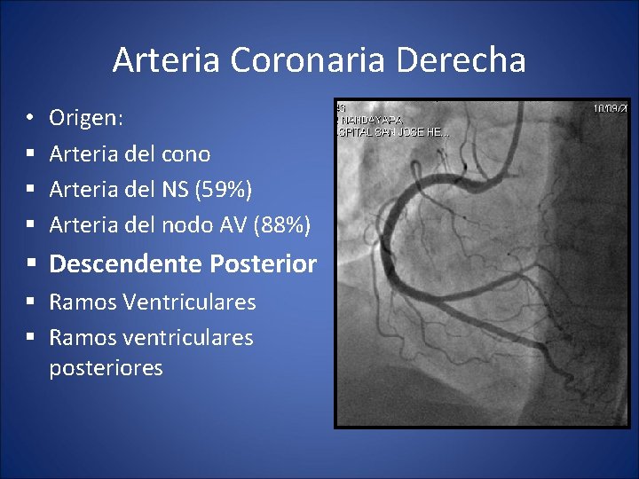 Arteria Coronaria Derecha • § § § Origen: Arteria del cono Arteria del NS