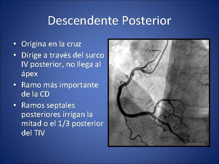 Descendente Posterior • Origina en la cruz • Dirige a través del surco IV