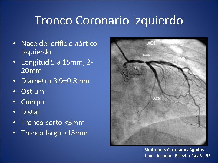 Tronco Coronario Izquierdo • Nace del orificio aórtico izquierdo • Longitud 5 a 15