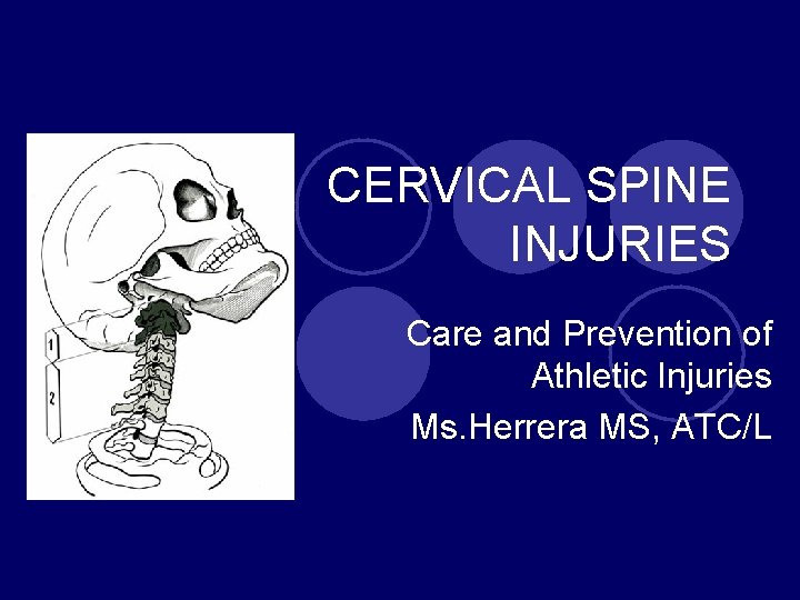 CERVICAL SPINE INJURIES Care and Prevention of Athletic Injuries Ms. Herrera MS, ATC/L 