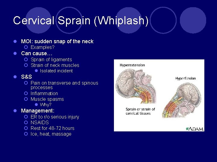 Cervical Sprain (Whiplash) l MOI: sudden snap of the neck ¡ Examples? l Can