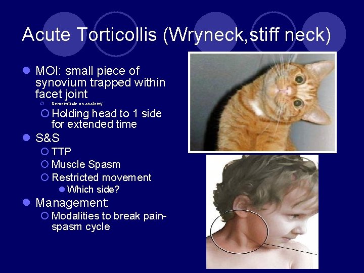 Acute Torticollis (Wryneck, stiff neck) l MOI: small piece of synovium trapped within facet
