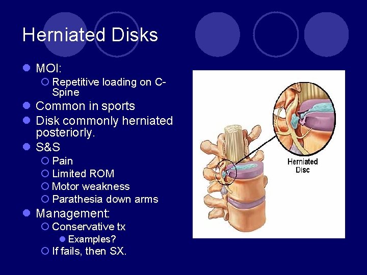 Herniated Disks l MOI: ¡ Repetitive loading on CSpine l Common in sports l