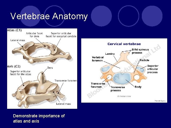 Vertebrae Anatomy Demonstrate importance of atlas and axis 