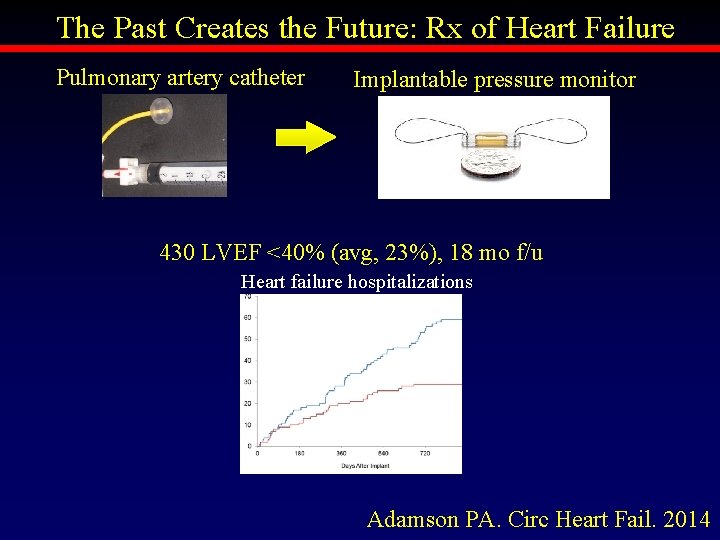 The Past Creates the Future: Rx of Heart Failure Pulmonary artery catheter Implantable pressure