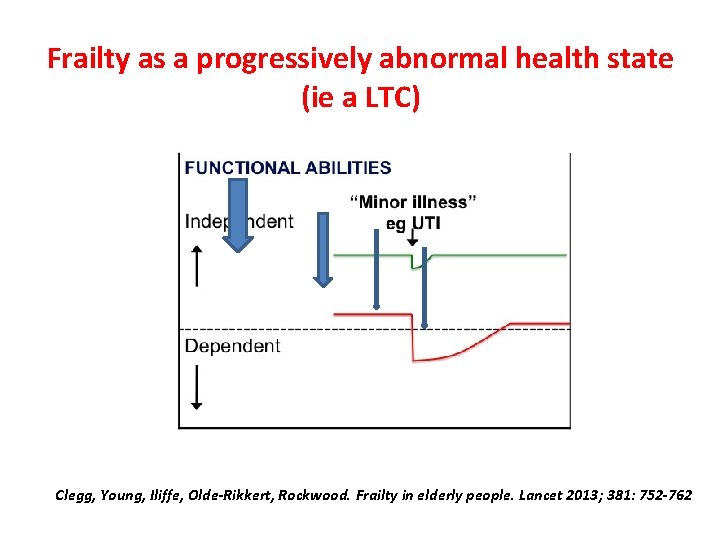 Frailty as a progressively abnormal health state (ie a LTC) Clegg, Young, Iliffe, Olde-Rikkert,