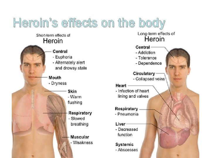 Heroin’s effects on the body 