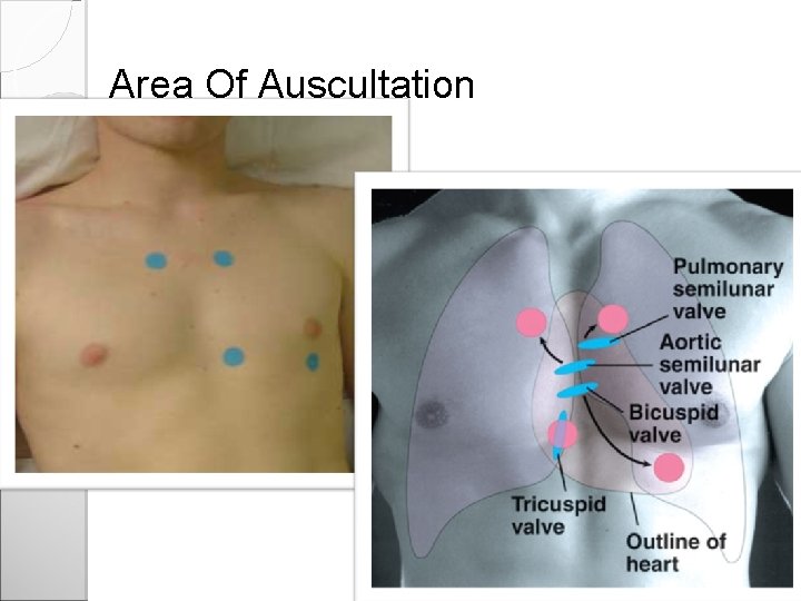 Area Of Auscultation 