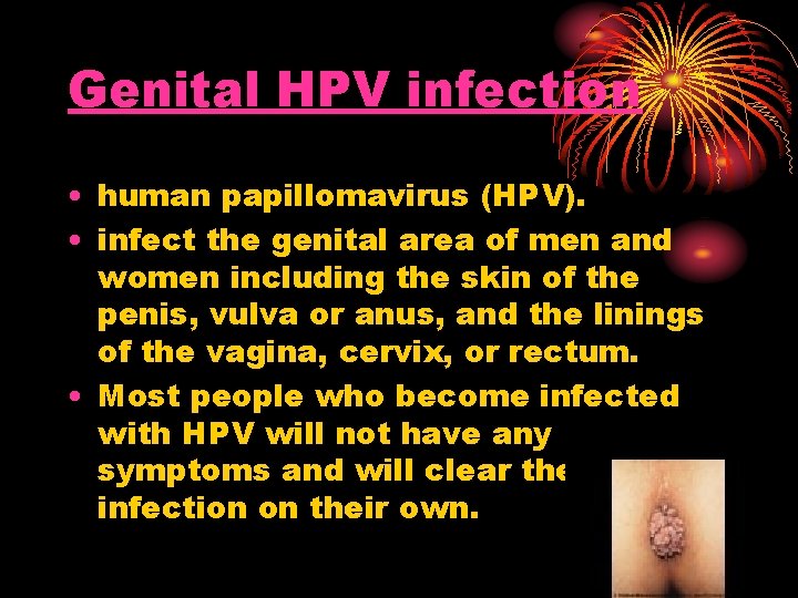Genital HPV infection • human papillomavirus (HPV). • infect the genital area of men Genital HPV infection • human papillomavirus (HPV). • infect the genital area of men