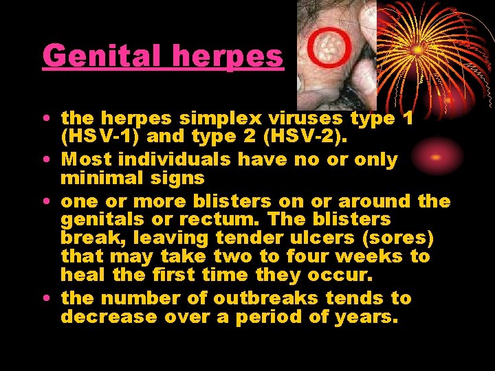 Genital herpes • the herpes simplex viruses type 1 (HSV-1) and type 2 (HSV-2). Genital herpes • the herpes simplex viruses type 1 (HSV-1) and type 2 (HSV-2).