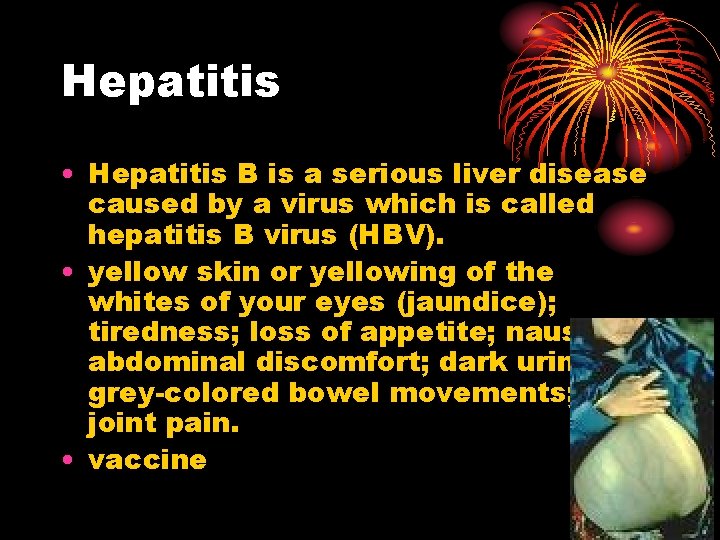 Hepatitis • Hepatitis B is a serious liver disease caused by a virus which Hepatitis • Hepatitis B is a serious liver disease caused by a virus which