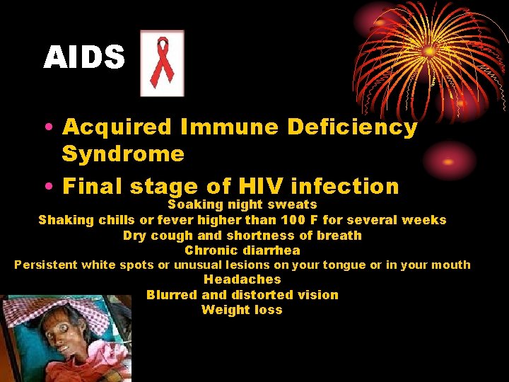 AIDS • Acquired Immune Deficiency Syndrome • Final stage of HIV infection Soaking night AIDS • Acquired Immune Deficiency Syndrome • Final stage of HIV infection Soaking night