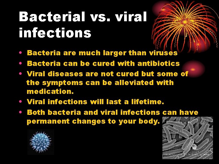 Bacterial vs. viral infections • Bacteria are much larger than viruses • Bacteria can Bacterial vs. viral infections • Bacteria are much larger than viruses • Bacteria can
