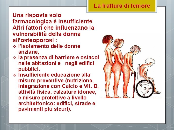 La frattura di femore Una risposta solo farmacologica è insufficiente Altri fattori che influenzano