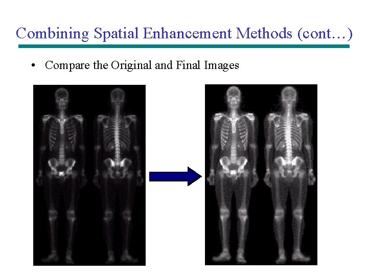 Combining Spatial Enhancement Methods (cont…) • Compare the Original and Final Images Combining Spatial Enhancement Methods (cont…) • Compare the Original and Final Images