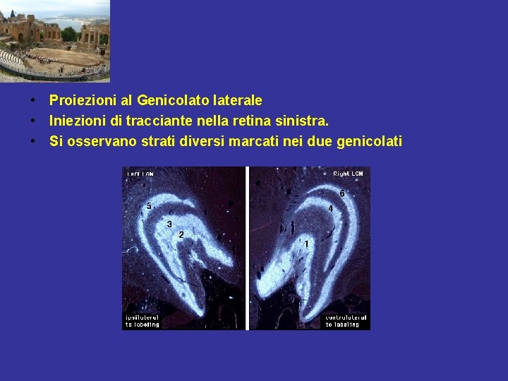  • Proiezioni al Genicolato laterale • Iniezioni di tracciante nella retina sinistra. •