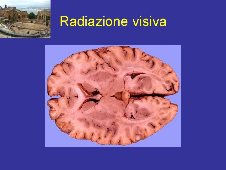 Radiazione visiva 