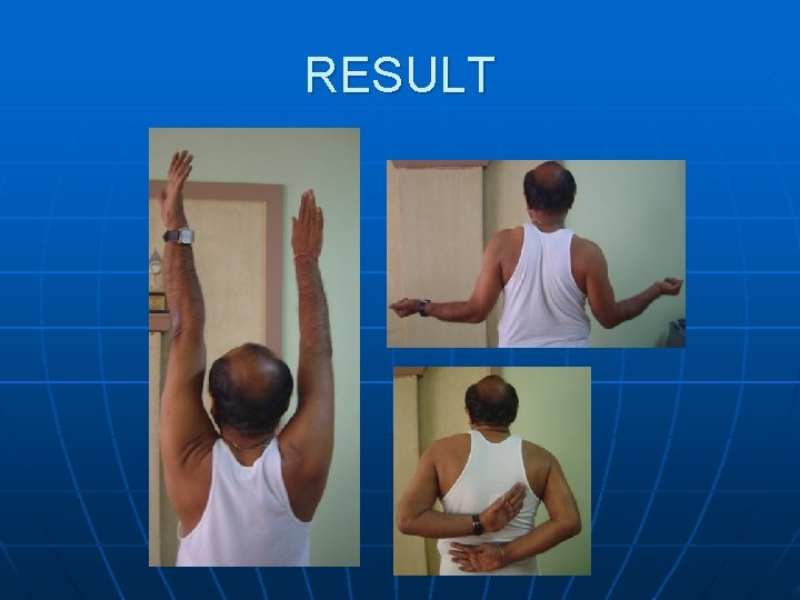 RESULT 