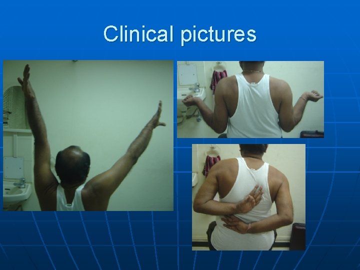 Clinical pictures 