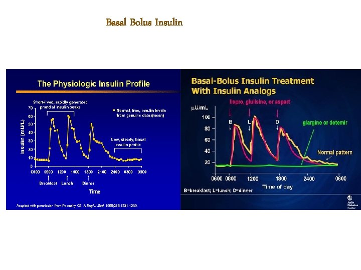 Basal Bolus Insulin 