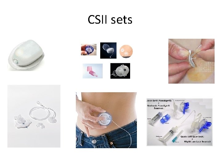 CSII sets 