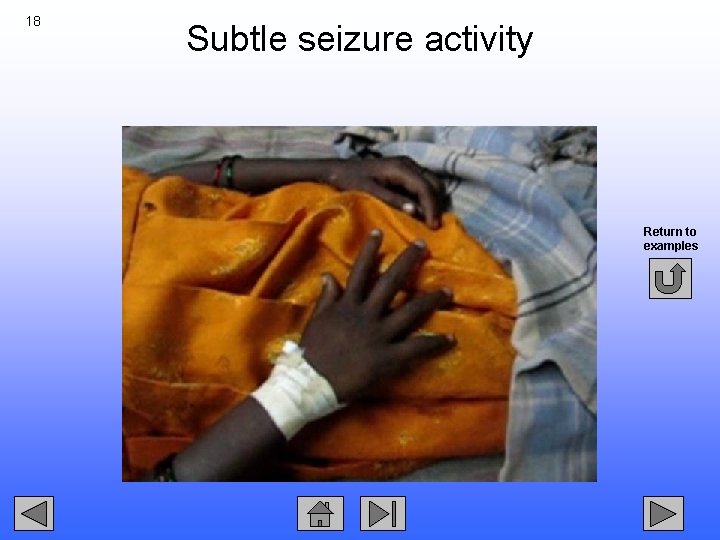 18 Subtle seizure activity Return to examples 