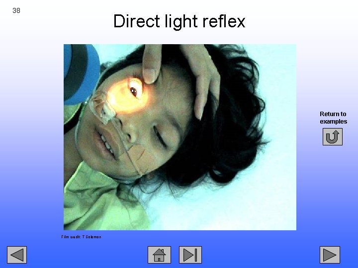 38 Direct light reflex Return to examples Film credit: T Solomon 