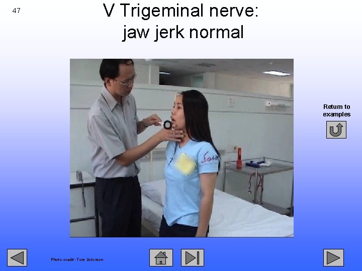 47 V Trigeminal nerve: jaw jerk normal Return to examples Photo credit: Tom Solomon