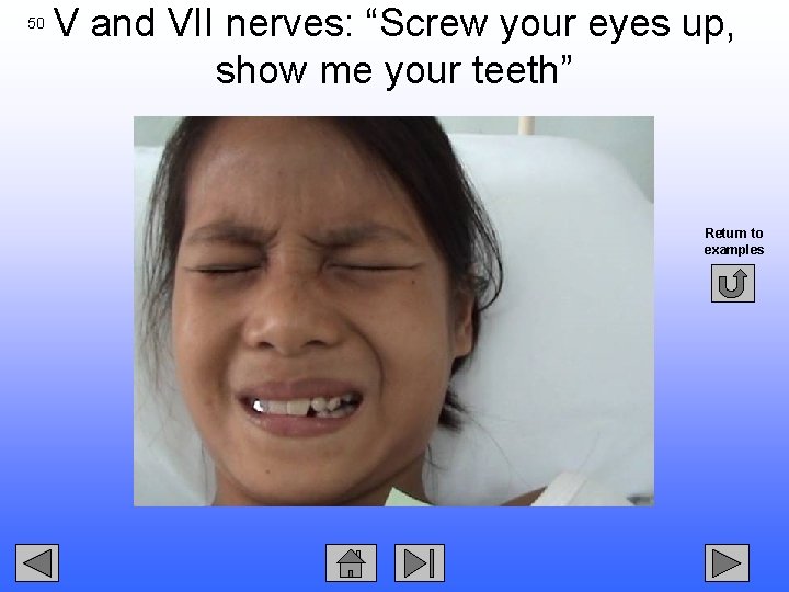 50 V and VII nerves: “Screw your eyes up, show me your teeth” Return
