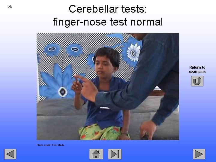 59 Cerebellar tests: finger-nose test normal Return to examples Photo credit: Tom Shulz 