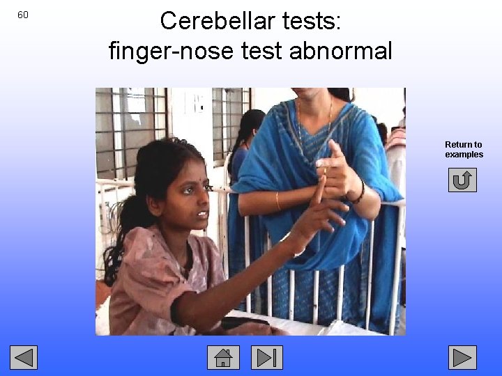 60 Cerebellar tests: finger-nose test abnormal Return to examples 