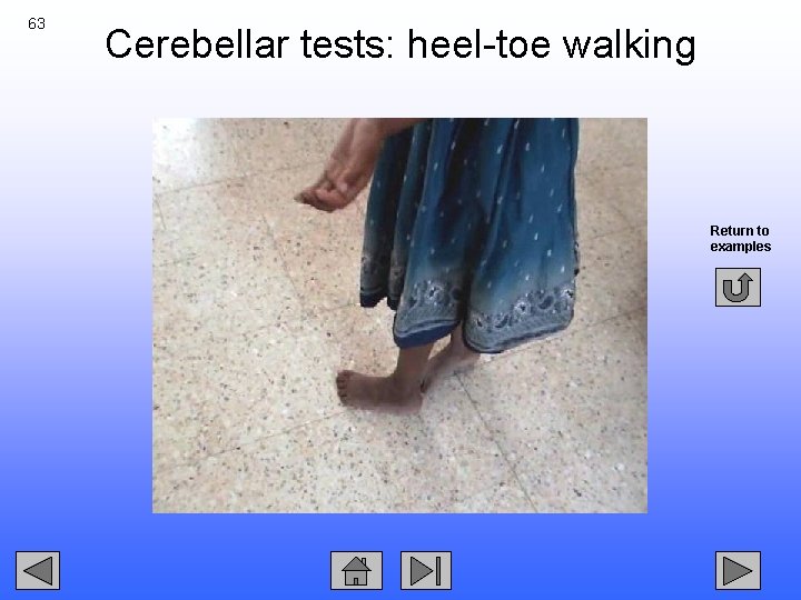 63 Cerebellar tests: heel-toe walking Return to examples 