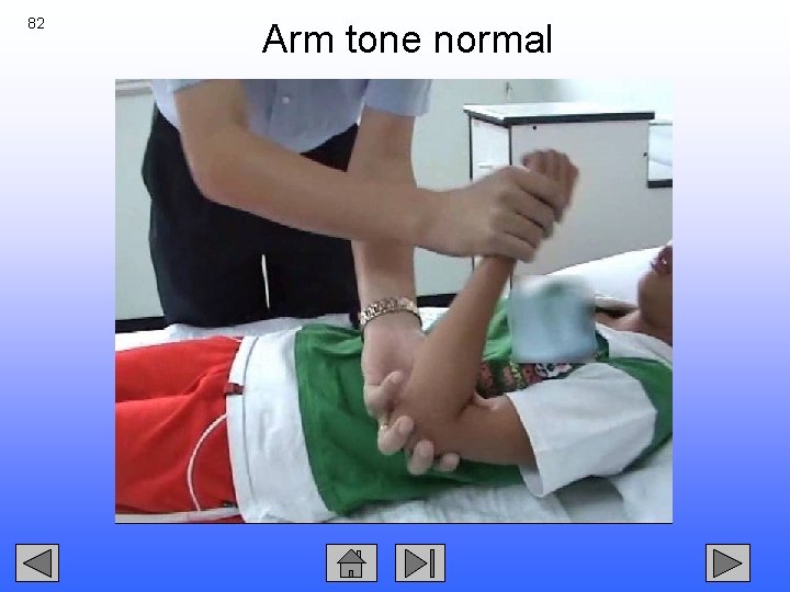 82 Arm tone normal 