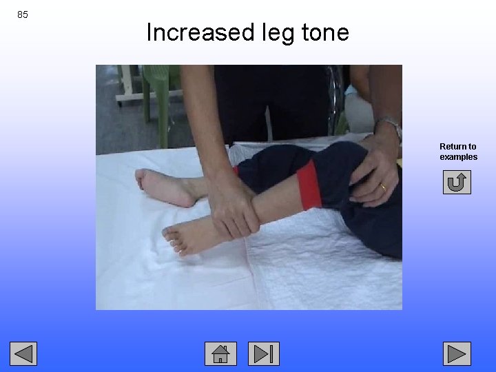 85 Increased leg tone Return to examples 