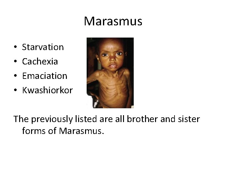 Marasmus • • Starvation Cachexia Emaciation Kwashiorkor The previously listed are all brother and