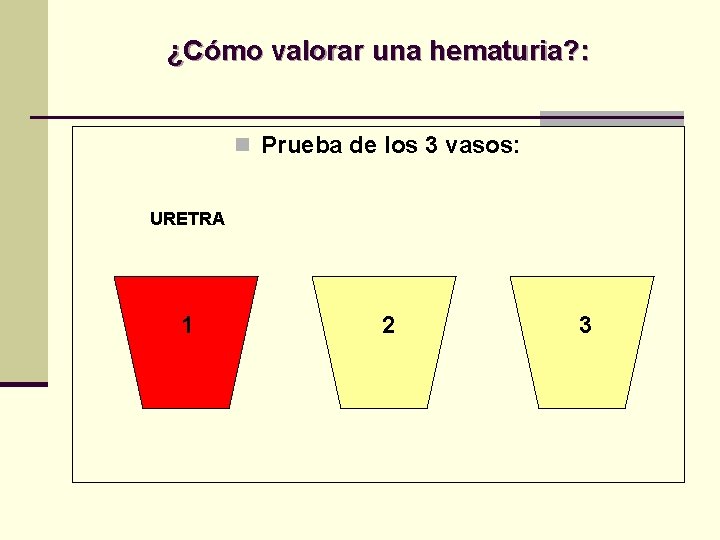 ¿Cómo valorar una hematuria? : n Prueba de los 3 vasos: URETRA 1 2 ¿Cómo valorar una hematuria? : n Prueba de los 3 vasos: URETRA 1 2