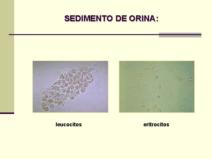 SEDIMENTO DE ORINA: leucocitos eritrocitos SEDIMENTO DE ORINA: leucocitos eritrocitos