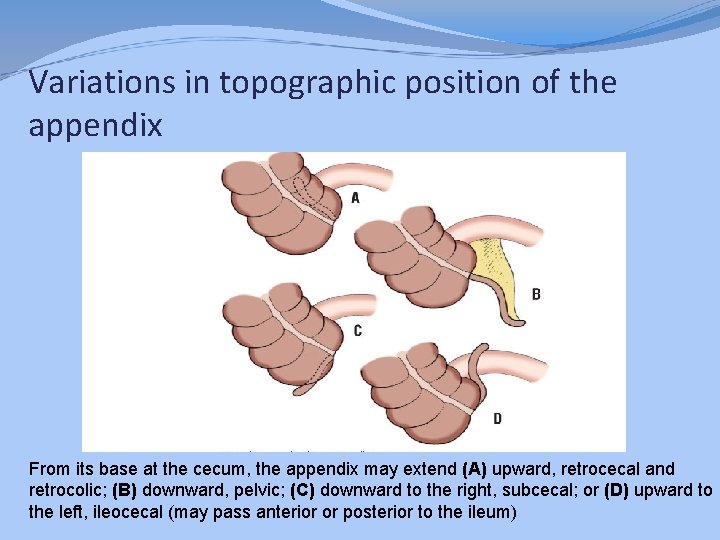 Variations in topographic position of the appendix From its base at the cecum, the