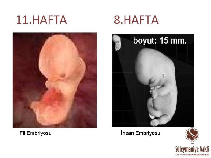 11. HAFTA Fil Embriyosu 8. HAFTA İnsan Embriyosu 