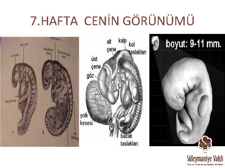 7. HAFTA CENİN GÖRÜNÜMÜ 